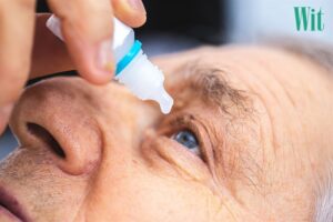 1156 cham soc mat sau mo